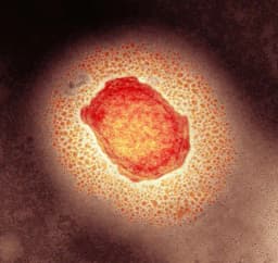 100+ monkeypox cases in US by October 31?